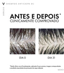 DERCOS SHAMPOO ANTICASPA DS CABELOS NORMAIS A OLEOSOS