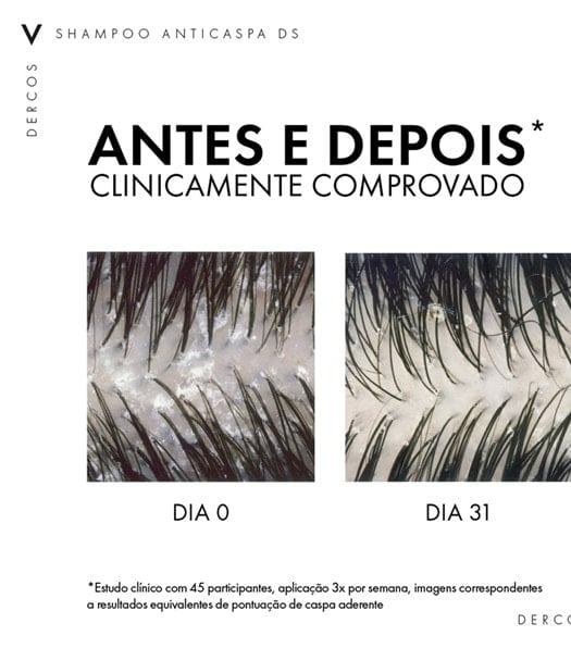 DERCOS SHAMPOO ANTICASPA DS CABELOS NORMAIS A OLEOSOS