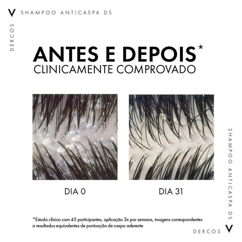 DERCOS SHAMPOO ANTICASPA INTENSIVO DS CABELOS SECOS